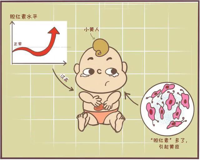 [你的育儿经]新生儿黄疸是怎么回事？