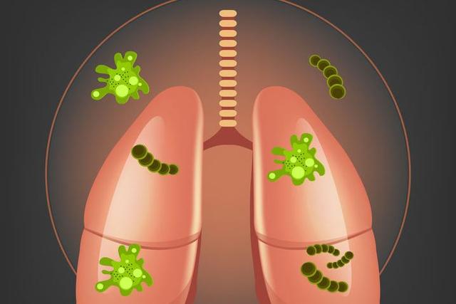 肺脏敲警钟！出现3个不良症状，正是肺癌“露马脚”