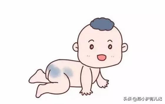 你的育儿经|新生儿屁股淤青怎么回事？如果属于这三种“胎记”记得看医生