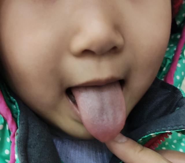 [你的育儿经]你的脾胃健康吗？