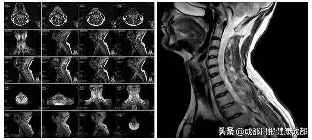 检查|如何选择医学影像检查？影像科医生来教你