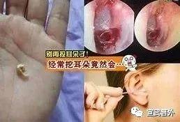 你的耳朵其实不需要“挠痒痒”