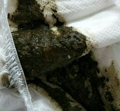 「暖先生格调」宝宝拉绿便就是奶粉的“锅”？饥饿、辅食......这些都可能，附图干货拿去！