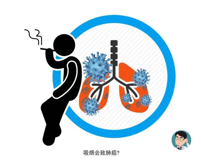 癌症复发，只因运气不好？日常这7个共性，看看你是否曾犯过？