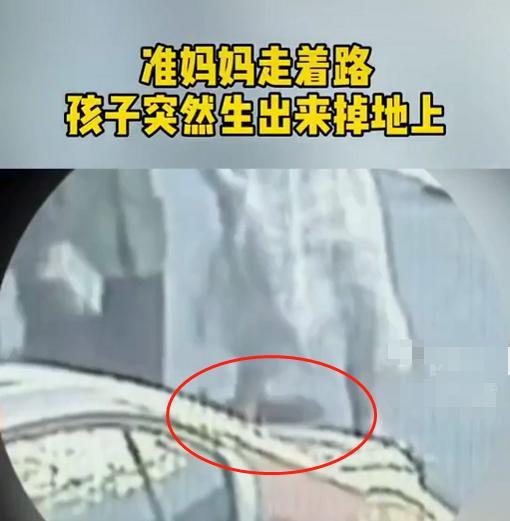超级宝妈@孕妇行走时分娩，胎儿突然掉到地上，引得路人围观