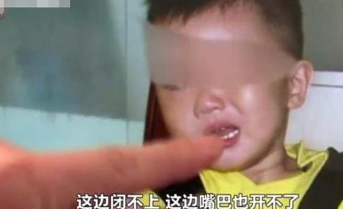 超级宝妈|3岁男孩成面瘫，医生：夏日带娃，父母别做这3件事，会坑了孩子