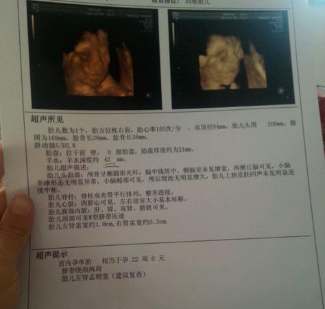 「超级宝妈」妈妈哭的时候,胎儿会难过吗?一篇“孕期四维检查”告诉你答案