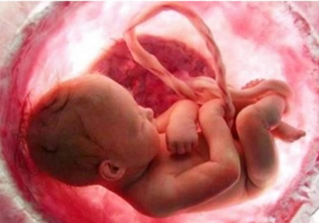 「你的育儿经」怀孕12周做b超为什么胎儿不动？有两种情况，附胎动时间和位置