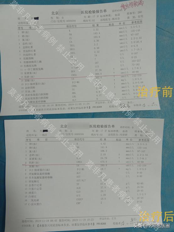 17岁少女遇肾衰，透析成噩梦，再寻医后噩梦乍醒，生活又归安宁