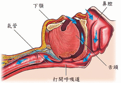 南浔的梦|米医生：腺样体手术后，为何孩子仍打呼、张嘴呼吸、严重黑眼圈？