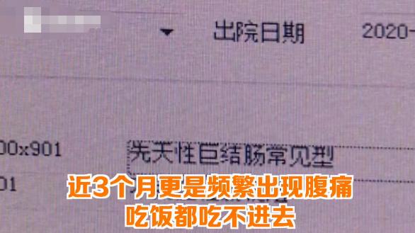 30天才排便一次！22岁女孩饱受便秘折磨，肠管内堆满粪便