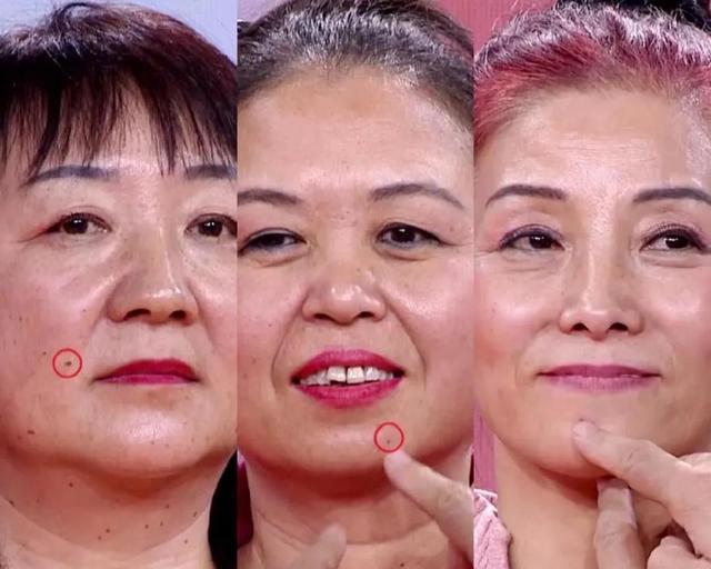 脸上三角区有色素沉着，易患肠息肉！一杯代茶饮，预防息肉少复发