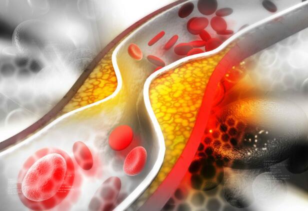 得了高血脂，不妨多吃这6种食物，或能让血脂平稳不升高