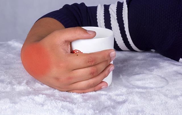 经常出现手脚发麻？或许和3种慢性病有关