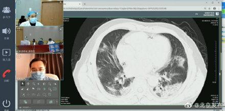 光明网▲北京院士“后排助攻”，5G远程CT会诊落地雷神山