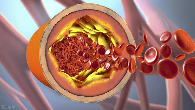 注意，这5个“夺命”的血管保养知识，坑害了多少国人？