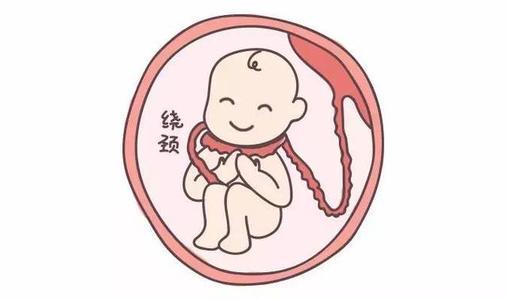 【超级宝妈】胎儿脐带绕颈发生率20%，该怎么办？孕妈不要瞎折腾，要这样做！