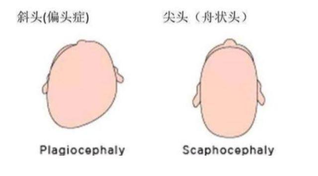 #你的育儿经#孩子后脑勺高就是聪明吗？父母不要再被误导，信玄学不如信科学