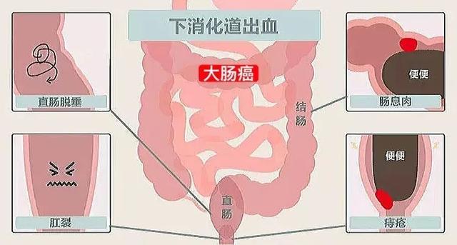 便后的这个动作，相当于一次小体检