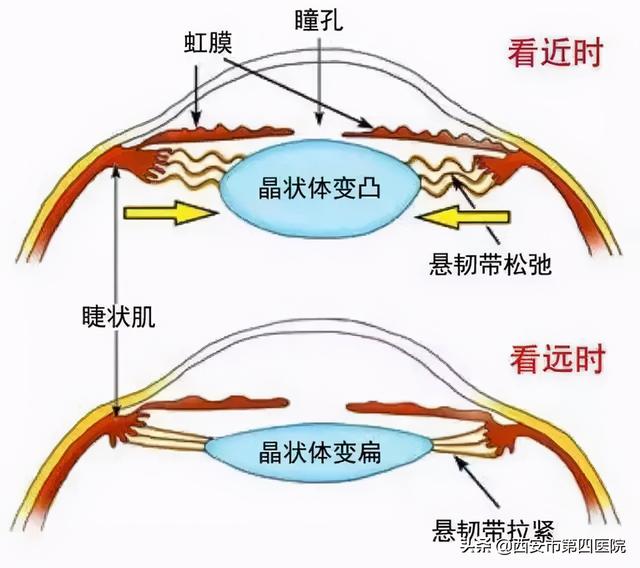 【清晰视界】近视术后早期看近处不清楚？答案都在这↓↓↓