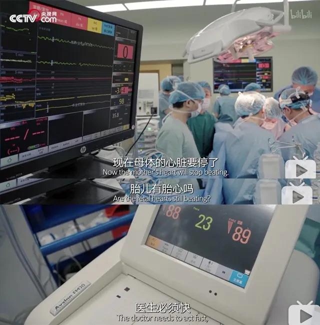你的育儿经▲胎梦和未来宝宝有关联？这背后还真有科学道理