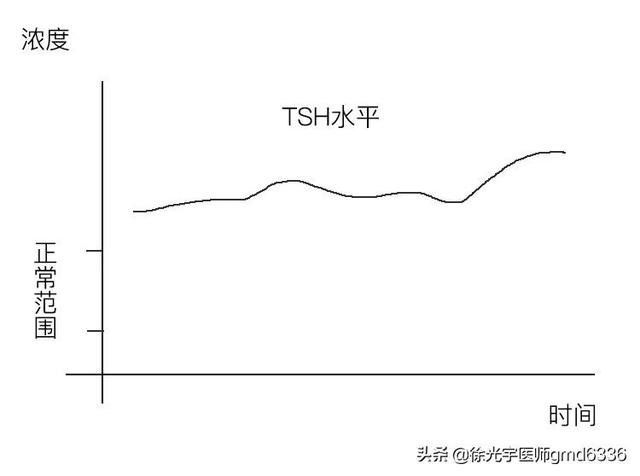 小于1厘米的微小癌，可以观察不手术？看看专家是怎么建议的