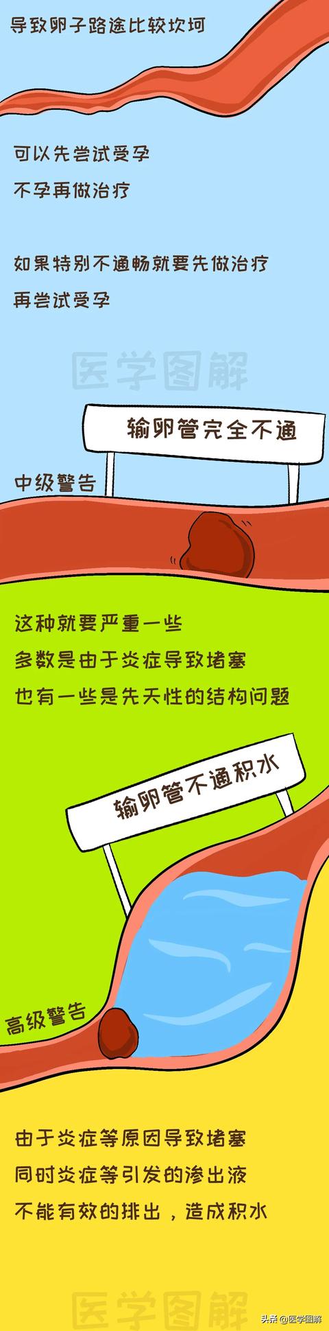 超级宝妈■女性怀孕的重要通道，不孕可能来自这里丨医学图解