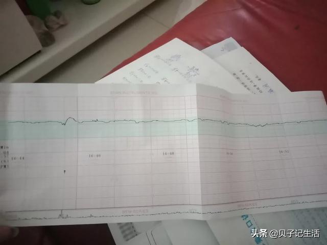 你的育儿经：脐带绕颈三圈 自然生产，大出血宝妈的苦逼生产史。