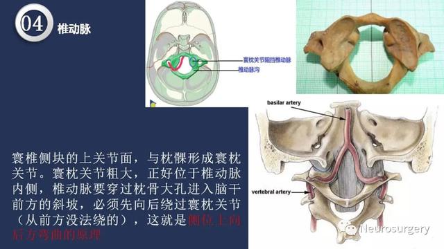 头颈动脉系统相关解剖