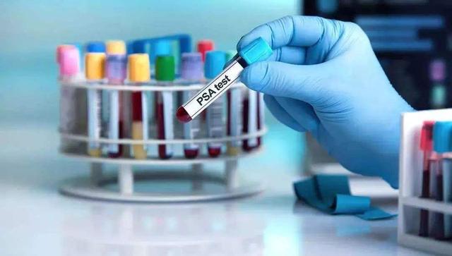 这些常见癌症，美国用4种简单抗癌方法，让200多万人避免患癌