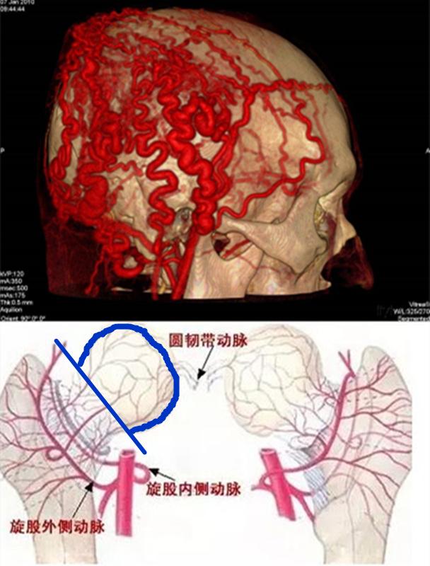 手术|「辟谣」手术是为了促进骨折愈合？错！敷中药往往更能促进愈合