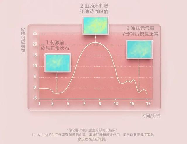 拒绝冬日红鼻子，宝妈过冬囤货就看这篇