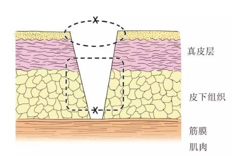 超级宝妈|宝宝摔伤后怎么做才能不留疤？这些护理方法每位家长都要Get到