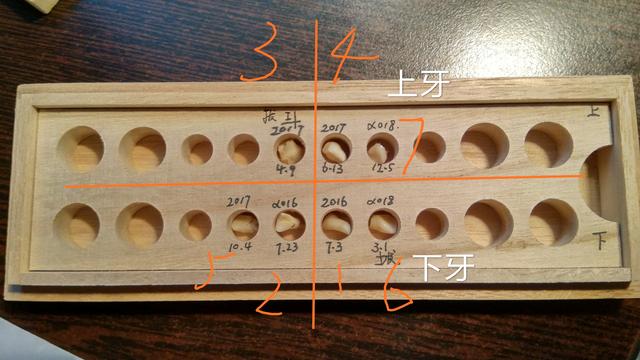 送给孩子正在换牙的父母们，你们一直都做错了什么？