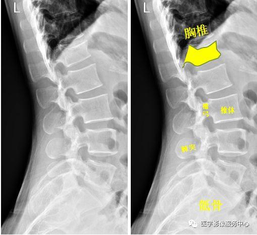 独立值班了 这些骨折你都看出来了吗（附注解）