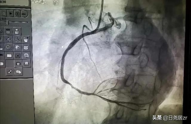 能把人从死亡边缘拉回来的人——佳木斯市中心医院“翁志远”主任