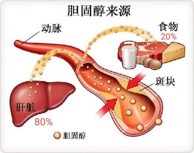 心脑血管病的祸根“低密度脂蛋白胆固醇”，做到这几点就能控制