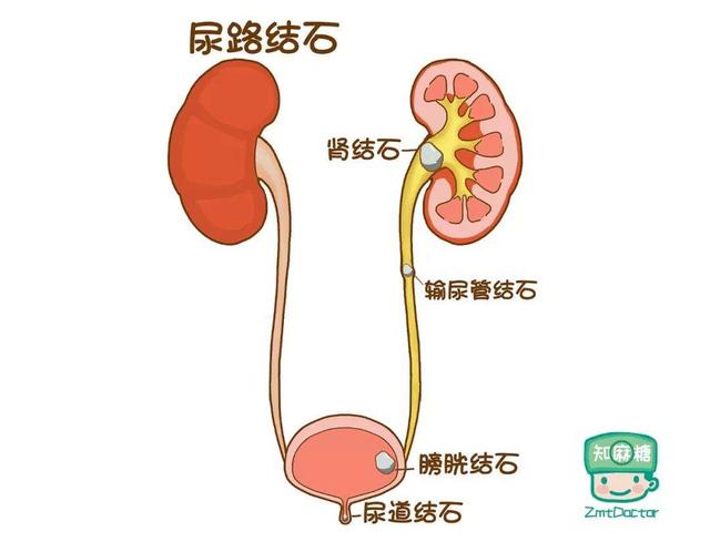 腰痛了该看哪个科？