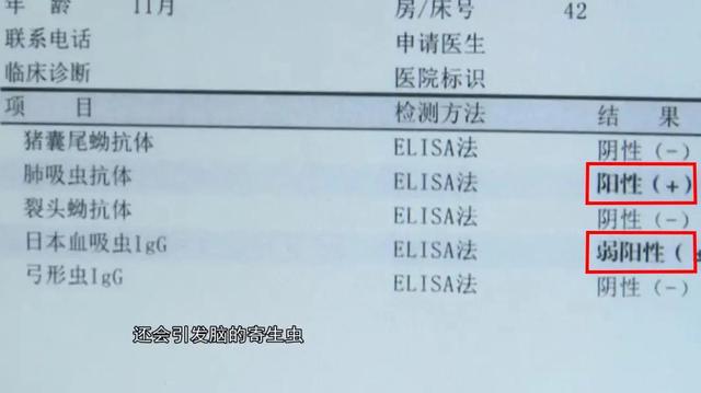 连续发热、呕吐一周，广东1岁男童感染多种寄生虫