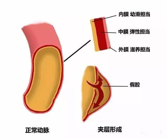 36岁男星黄鸿升因它去世！寒冬到，警惕这个“隐形杀手”