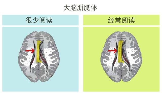 脑神经科学表明：“爱阅读”和“不爱阅读”的孩子，大脑差距很大