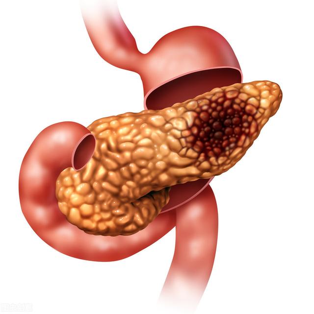 WebMD：对于疾病，不同的血型，不同的影响