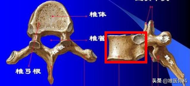 驼背|老年人为什么会驼背，而且越老越驼？