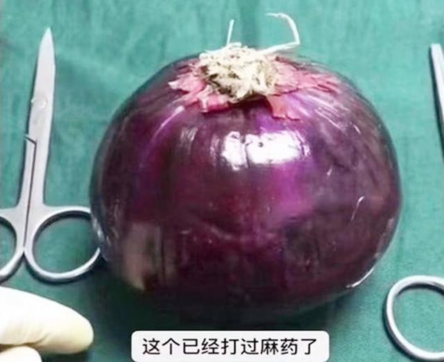 你的育儿经|选剖腹产不疼？这根10厘米的麻醉针仅仅是开始，疼到你怀疑人生