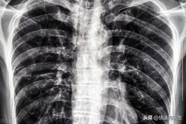 女性在备孕或孕期，哪些检查能做，哪些不能做！千万记住了