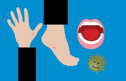 手足|宝宝手足口病高发期，这样做不“中招”