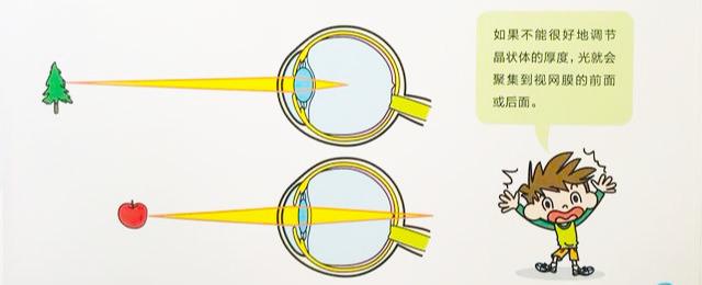 【超级宝妈】为啥近视看不清，为啥非要做眼操？关于眼睛的奥秘都在这里
