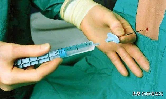 「你的育儿经」亲自经历剖腹产历程,每一步都惊心动魄,男人必须要看