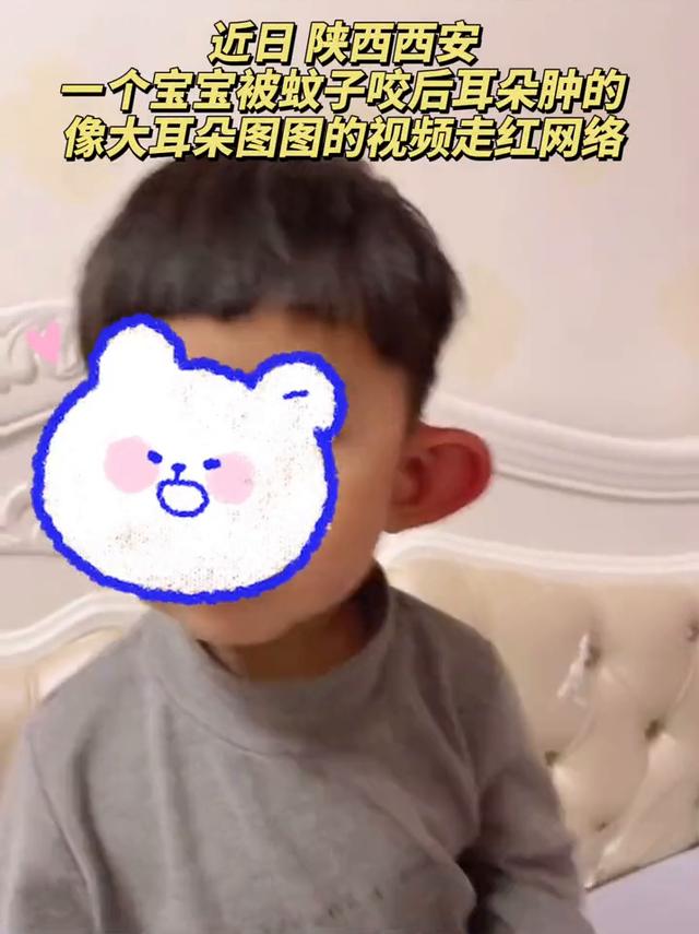 宝宝|萌娃耳朵被蚊子叮成大耳朵图图！妈妈：耳朵大了一倍 厚了一倍