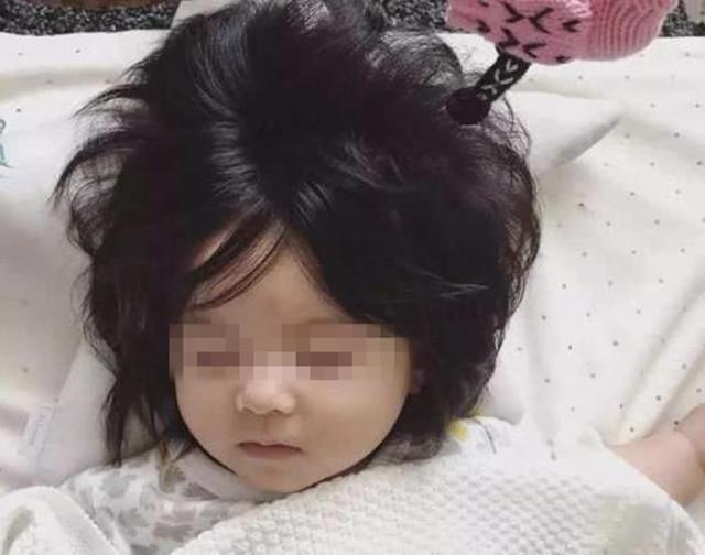 南浔的梦|为何有些新生儿头发浓密，有些宝宝像“小光头”？3个原因需重视